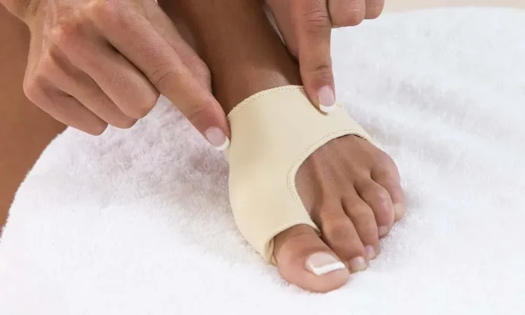 Causes of Bunions