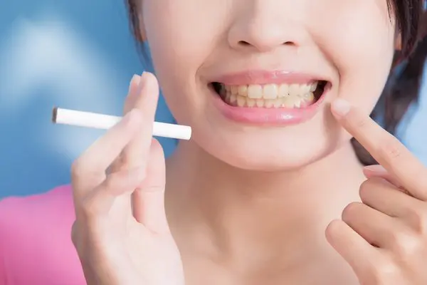 Dental Care Tips For Smokers